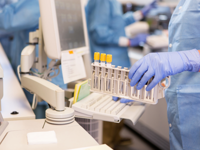 جهاز تحليل الدم